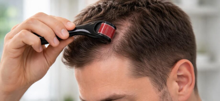 découvrez comment utiliser un dermaroller pour cheveux afin de stimuler la croissance capillaire efficacement et favoriser un cuir chevelu sain.